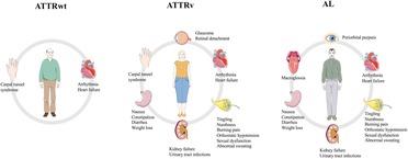 Screening approaches to cardiac amyloidosis in different clinical settings: Current practice and future perspectives